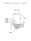 Method and means to adjust the positioning of stimulating neural and     muscular electrode diagram and image