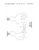 NEUROSTIMULATION PROGRAMMERS WITH IMPROVED RF ANTENNA RADIATION PATTERNS diagram and image