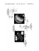 NEUROSTIMULATION PROGRAMMERS WITH IMPROVED RF ANTENNA RADIATION PATTERNS diagram and image