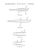 Stent Connector Bump Design diagram and image