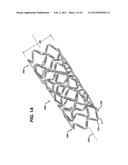 FLEXIBLE HELICAL STENT HAVING INTERMEDIATE STRUCTURAL FEATURE diagram and image