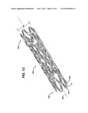 FLEXIBLE HELICAL STENT HAVING INTERMEDIATE STRUCTURAL FEATURE diagram and image