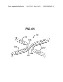 FLEXIBLE HELICAL STENT HAVING INTERMEDIATE STRUCTURAL FEATURE diagram and image