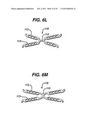 FLEXIBLE HELICAL STENT HAVING INTERMEDIATE STRUCTURAL FEATURE diagram and image