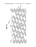 FLEXIBLE HELICAL STENT HAVING INTERMEDIATE STRUCTURAL FEATURE diagram and image