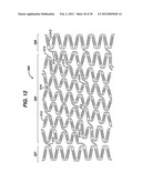 FLEXIBLE HELICAL STENT HAVING INTERMEDIATE STRUCTURAL FEATURE diagram and image