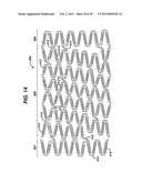 FLEXIBLE HELICAL STENT HAVING INTERMEDIATE STRUCTURAL FEATURE diagram and image