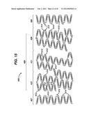 FLEXIBLE HELICAL STENT HAVING INTERMEDIATE STRUCTURAL FEATURE diagram and image