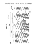 FLEXIBLE HELICAL STENT HAVING INTERMEDIATE STRUCTURAL FEATURE diagram and image