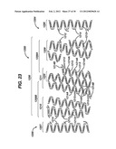 FLEXIBLE HELICAL STENT HAVING INTERMEDIATE STRUCTURAL FEATURE diagram and image