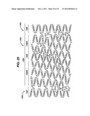 FLEXIBLE HELICAL STENT HAVING INTERMEDIATE STRUCTURAL FEATURE diagram and image