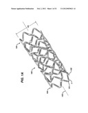 FLEXIBLE HELICAL STENT HAVING INTERMEDIATE NON-HELICAL REGION diagram and image