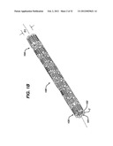 FLEXIBLE HELICAL STENT HAVING INTERMEDIATE NON-HELICAL REGION diagram and image