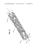 FLEXIBLE HELICAL STENT HAVING INTERMEDIATE NON-HELICAL REGION diagram and image