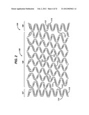 FLEXIBLE HELICAL STENT HAVING INTERMEDIATE NON-HELICAL REGION diagram and image