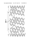 FLEXIBLE HELICAL STENT HAVING INTERMEDIATE NON-HELICAL REGION diagram and image