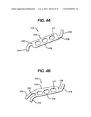 FLEXIBLE HELICAL STENT HAVING INTERMEDIATE NON-HELICAL REGION diagram and image