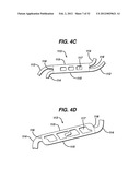 FLEXIBLE HELICAL STENT HAVING INTERMEDIATE NON-HELICAL REGION diagram and image