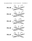 FLEXIBLE HELICAL STENT HAVING INTERMEDIATE NON-HELICAL REGION diagram and image