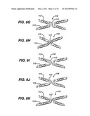 FLEXIBLE HELICAL STENT HAVING INTERMEDIATE NON-HELICAL REGION diagram and image