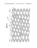 FLEXIBLE HELICAL STENT HAVING INTERMEDIATE NON-HELICAL REGION diagram and image