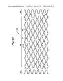 FLEXIBLE HELICAL STENT HAVING INTERMEDIATE NON-HELICAL REGION diagram and image