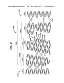 FLEXIBLE HELICAL STENT HAVING INTERMEDIATE NON-HELICAL REGION diagram and image