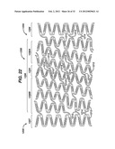 FLEXIBLE HELICAL STENT HAVING INTERMEDIATE NON-HELICAL REGION diagram and image