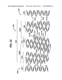 FLEXIBLE HELICAL STENT HAVING INTERMEDIATE NON-HELICAL REGION diagram and image