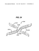 FLEXIBLE HELICAL STENT HAVING INTERMEDIATE NON-HELICAL REGION diagram and image