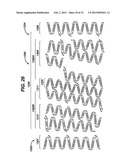 FLEXIBLE HELICAL STENT HAVING INTERMEDIATE NON-HELICAL REGION diagram and image