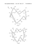 HYBRID STENT AND METHOD OF MAKING SUCH A STENT diagram and image