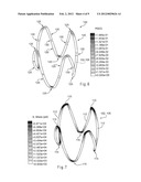 HYBRID STENT AND METHOD OF MAKING SUCH A STENT diagram and image