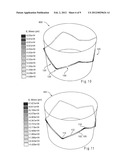 HYBRID STENT AND METHOD OF MAKING SUCH A STENT diagram and image