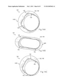 HYBRID STENT AND METHOD OF MAKING SUCH A STENT diagram and image