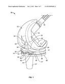 KNEE PROSTHESIS WITH ROTATABLE POST diagram and image