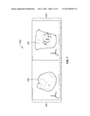 SYSTEMS AND METHODS FOR MODELING ELECTRICAL ACTIVITY OF AN ANATOMICAL     STRUCTURE diagram and image