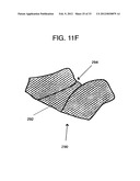 CRIB SHIELD SYSTEM AND OTHER BREATHABLE APPARATUS diagram and image