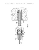 Cable Anchor diagram and image