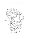 Dental device for preventing a sleep disorder diagram and image