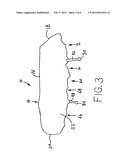 Dental device for preventing a sleep disorder diagram and image