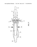 MOTORCYCLE diagram and image