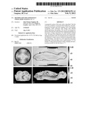 METHOD AND COILS FOR HUMAN WHOLE-BODY IMAGING AT 7 T diagram and image