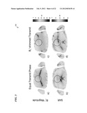 METHOD AND COILS FOR HUMAN WHOLE-BODY IMAGING AT 7 T diagram and image