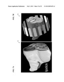 METHOD AND COILS FOR HUMAN WHOLE-BODY IMAGING AT 7 T diagram and image