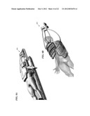 METHOD AND COILS FOR HUMAN WHOLE-BODY IMAGING AT 7 T diagram and image