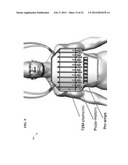 METHOD AND COILS FOR HUMAN WHOLE-BODY IMAGING AT 7 T diagram and image