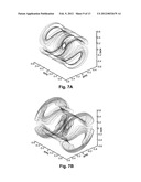 GRADIENT COIL ARRANGEMENT diagram and image