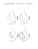 GRADIENT COIL ARRANGEMENT diagram and image