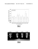 NON-INVASIVE TOOLS FOR DETECTING VULNERABLE ATHEROSCLEROTIC PLAQUES diagram and image